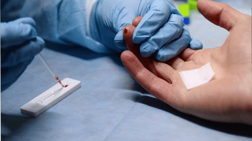 The City in Danger: Popenko explained why an outbreak of hepatitis A occurred in Kyiv